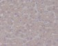 Anti-TrkA NTRK1 Rabbit Monoclonal Antibody